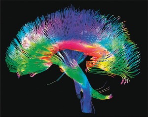 Human Brain Connectome or brain wiring diagram